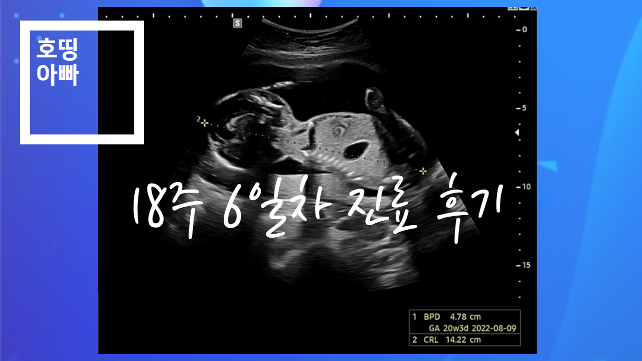 호띵이(태아) 18주 6일 검진 후기