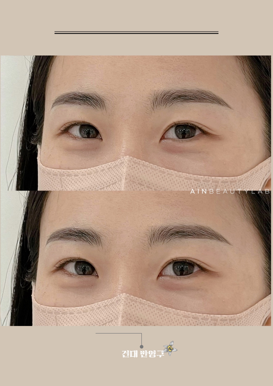  나의 얼굴형에 가장 잘 어울리는 눈썹문신 잘 하는곳 건대눈썹문신
