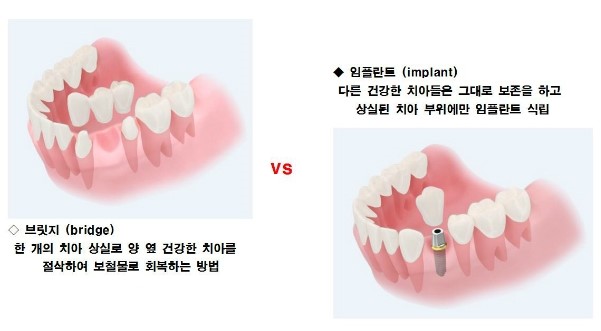 프라임치과 이미지