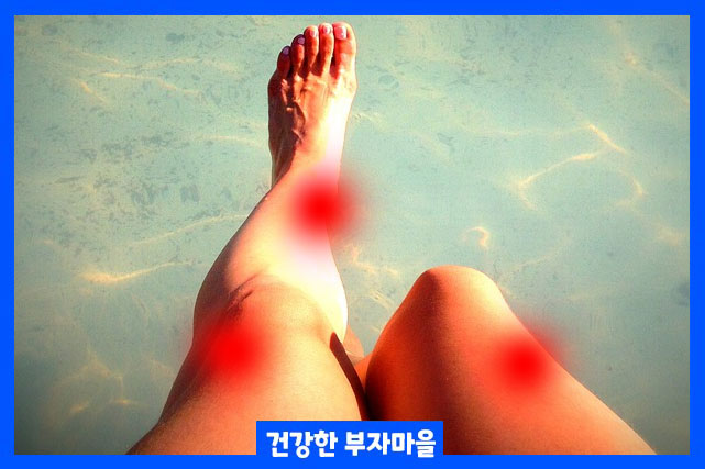 하지불안 증후군가 있는 사람은 다리와 때때로 팔에 이상하고 불쾌한 감각이 발생