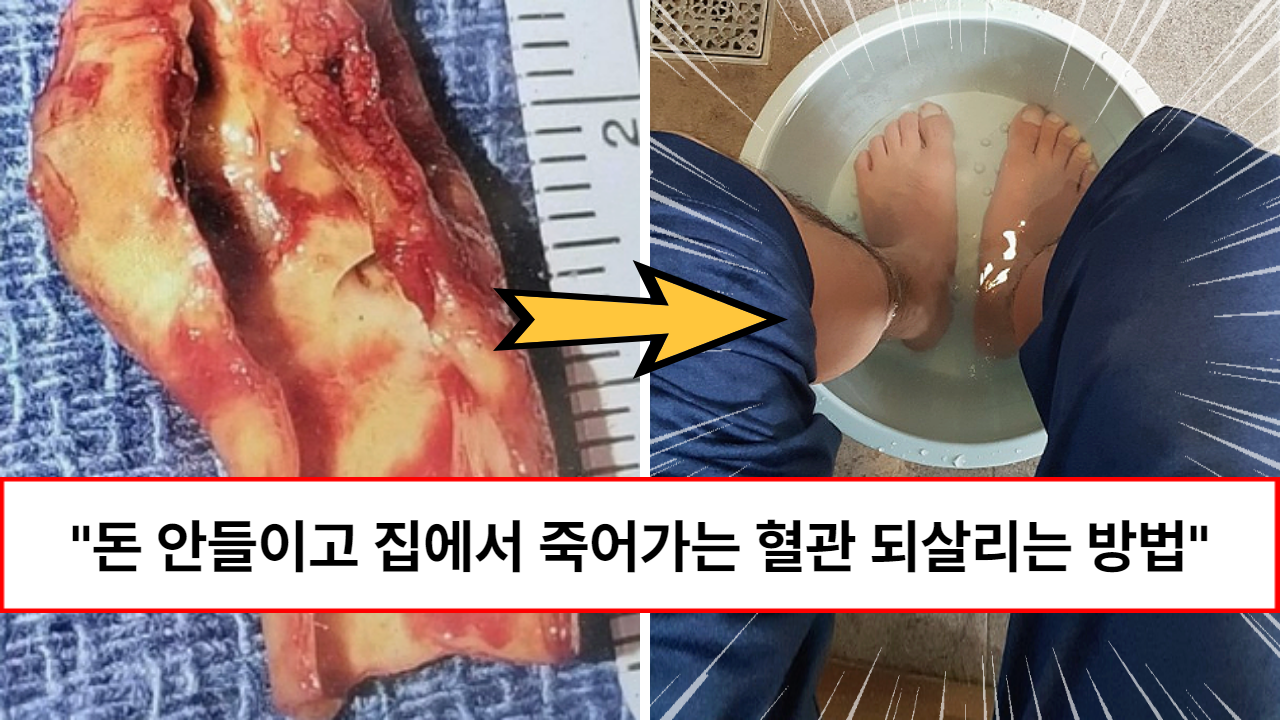 “티비보면서 발만 담그면 됩니다” 돈 한 푼 들이지 않고 20대와 같은 강력한 혈관으로 되돌리는 방법
