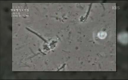 [670회] 생로병사의 비밀 - KBS670회] 생로병사의 비밀.ts_20220505_143158.779.jpg