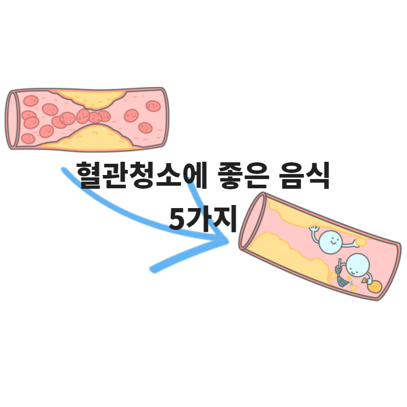  혈관청소에 좋은 음식 5가지 정리!