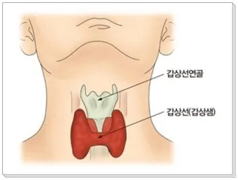 갑상샘 저하증 갑상선 기능저하증 증상 수치 치료_17