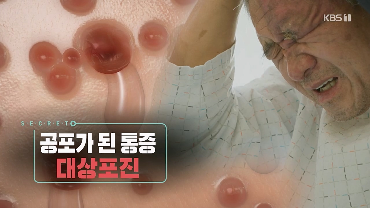 생로병사의 비밀.E857.230223p.H264-F1RST.mp4_20230223_200059.205.jpg