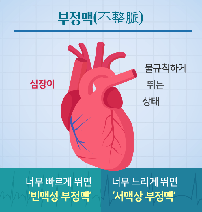  부정맥 원인 증상 유형을 알아보자