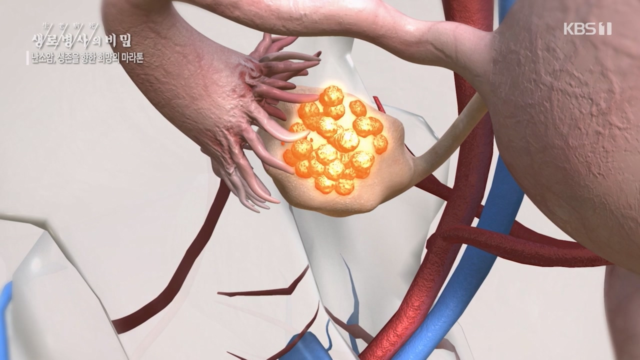 생로병사의 비밀.E878.230803p-NEXT.mp4_20230805_155630.218.jpg