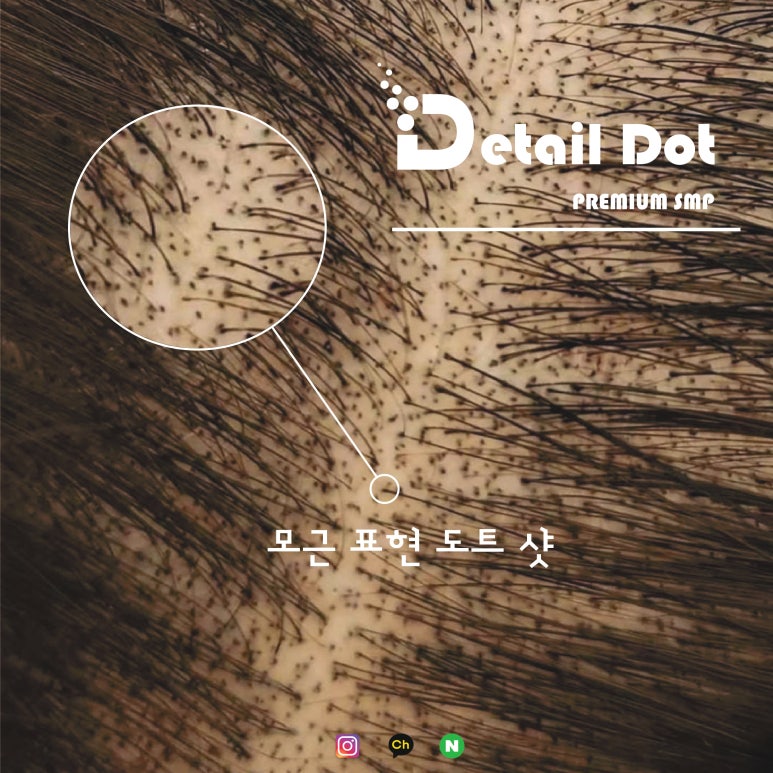 대구두피문신 모근 표현 도트
