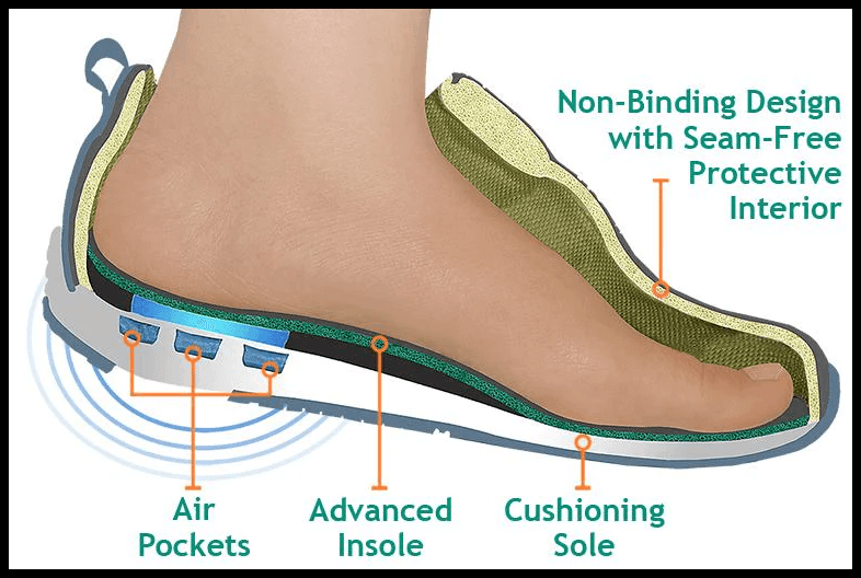 족저근막염의 증상&#44; 치료법 및 좋은 신발&#44; 깔창 고르는 법