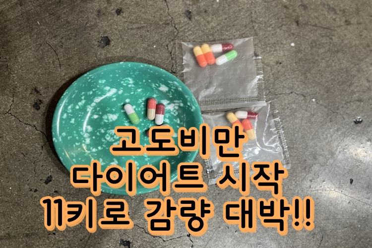 너무 많이 먹는 고지방 다이어트를 시작하십시오.