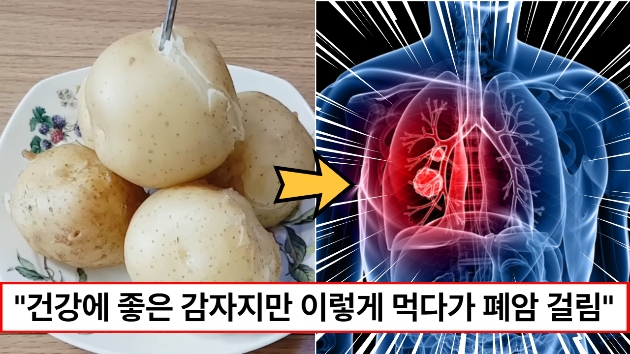 "감자 절대 이렇게 먹으면 안되요" 감자를 이렇게 먹으면 건강한 폐에 암세포가 생깁니다! 꼭 확인하고 건강하게 드세요.