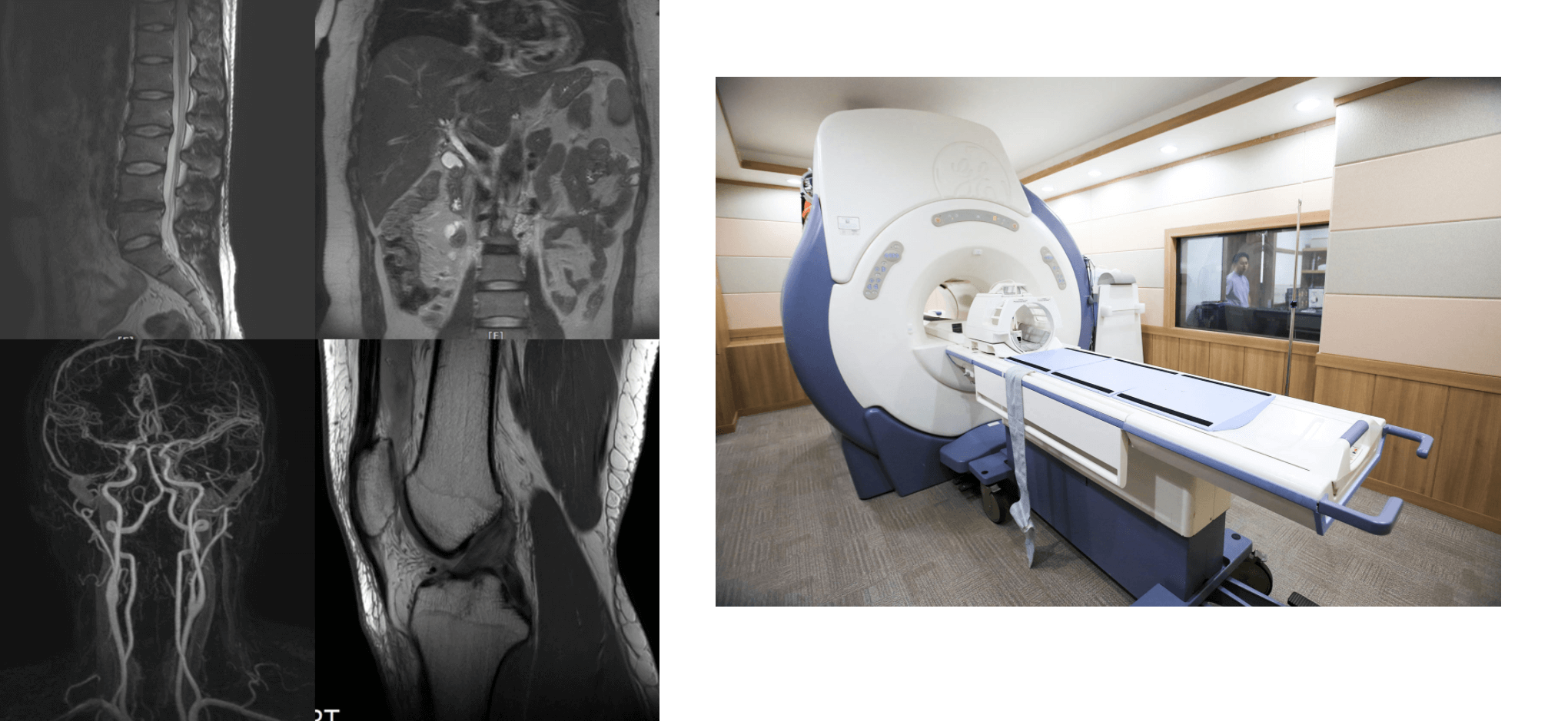 MRI-기계-모습과-촬영-결과-모습