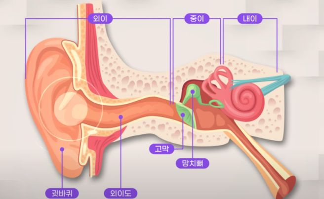 이관개방증 증상