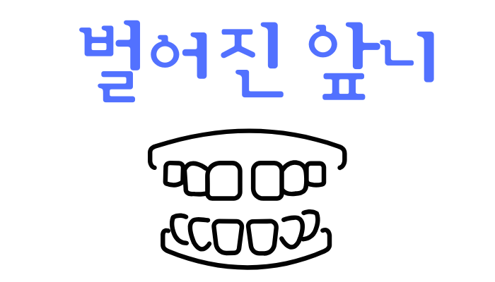 벌어진 앞니 교정 방법과 비용