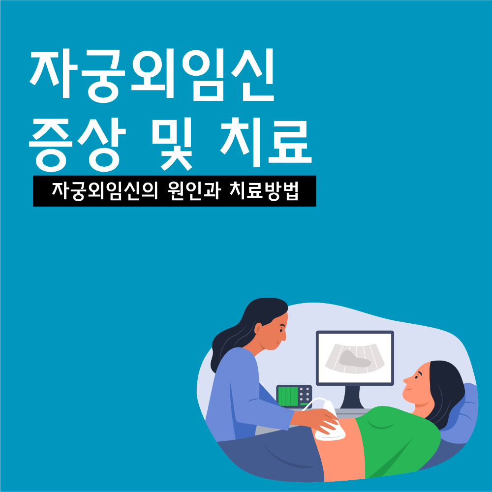 자궁외임신에 대해서