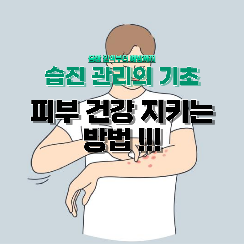 일상 속에서 쉽게 따를 수 있는 습진 관리 팁과 전문가의 조언을 통해 피부 건강을 지키는 방법을 배워보세요.