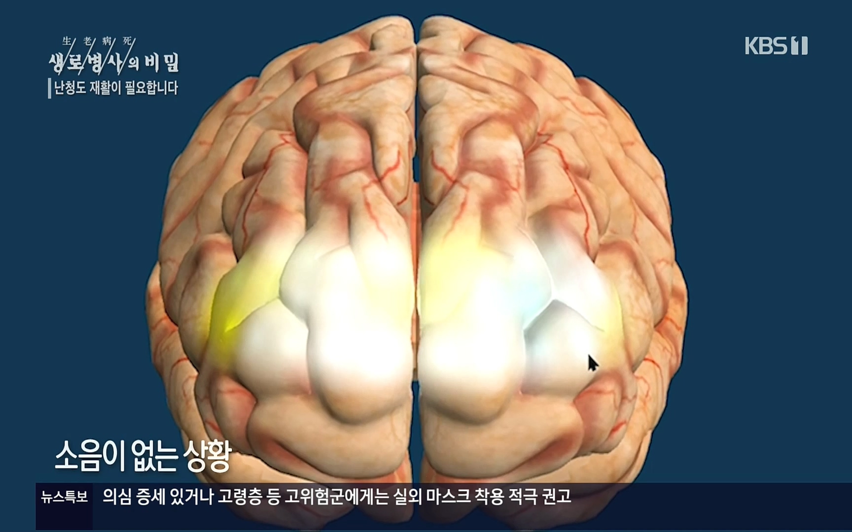 생로병사의 비밀.E837.220928p.H264-F1RST.mp4_20220930_212508.107.jpg