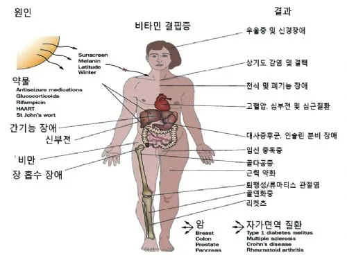 비타민d 부족증상