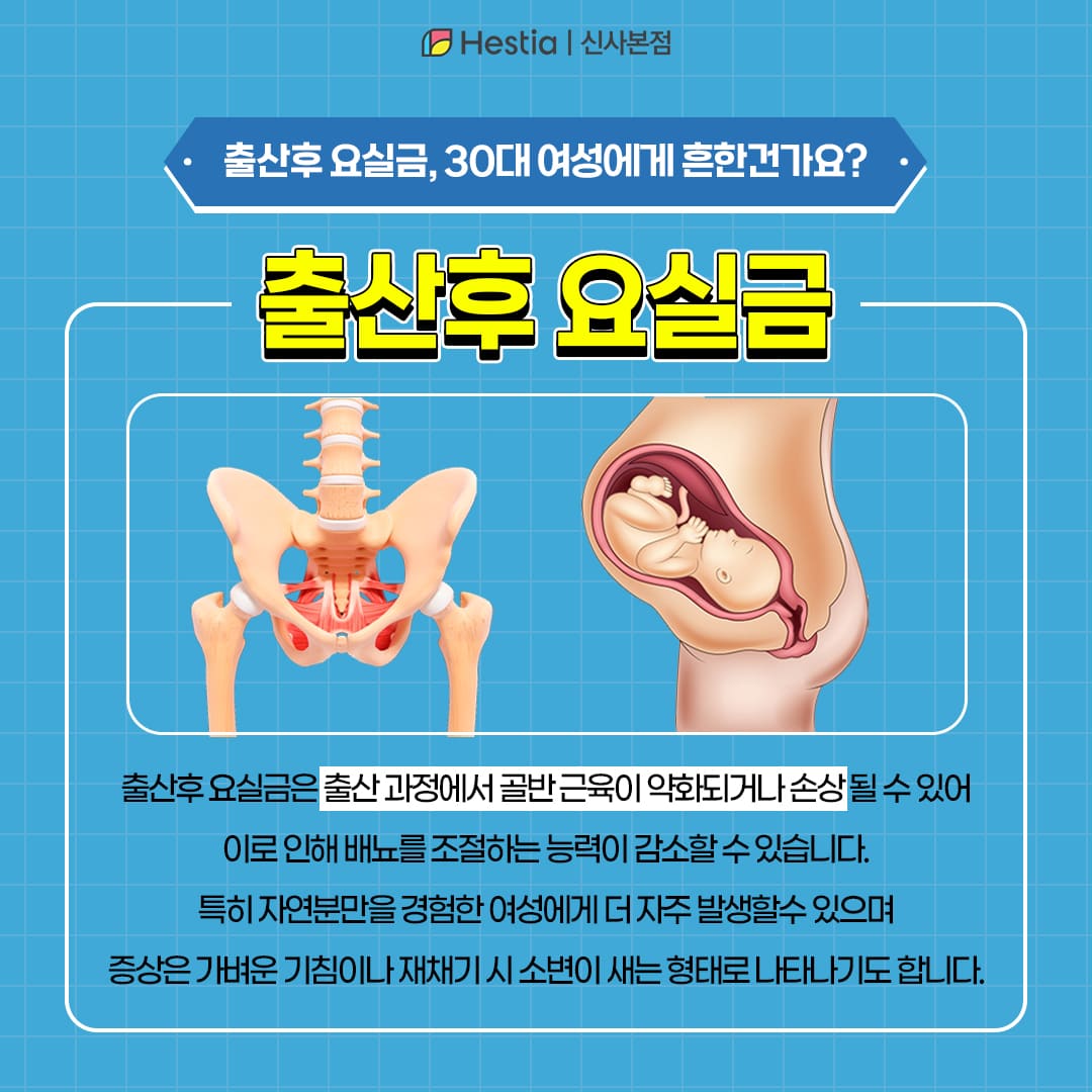 30대 출산후 요실금 흔한 건가요?