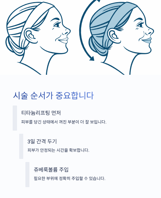 시술 순서가 중요합니다