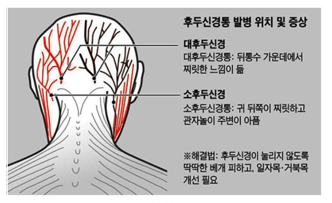 뒷골땡김