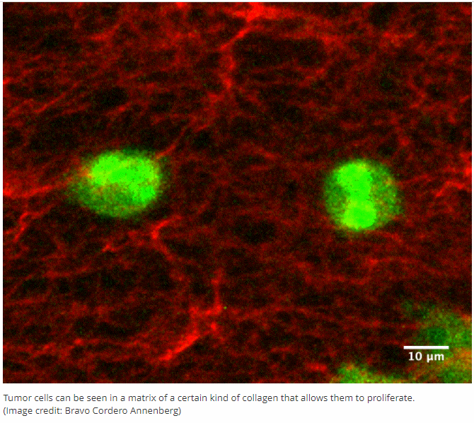  이 물질 미래의 암 치료제? Dormant cancer cells may 'reawaken' due to change in this key protein