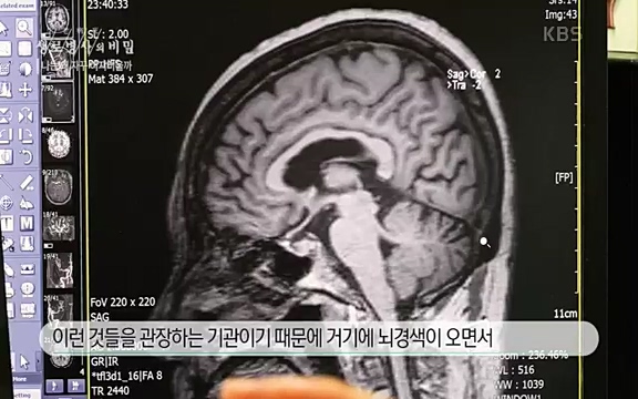 [830회] 생로병사의 비밀 - KBS830회] 생로병사의 비밀.ts_20220828_135424.494.jpg