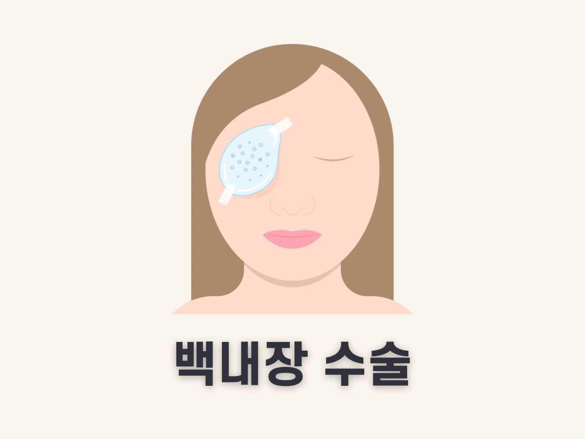 백내장 수술