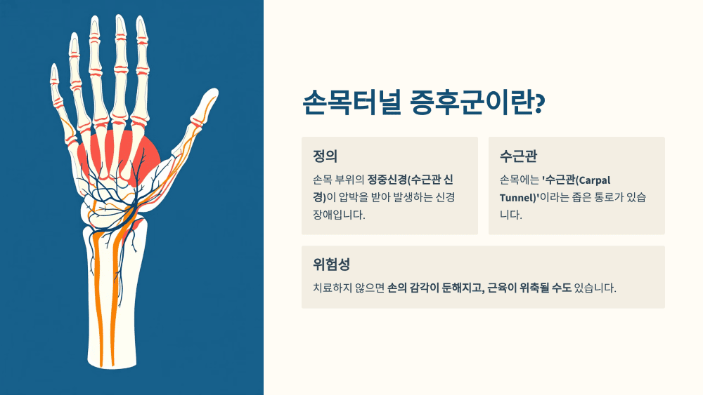 손목터널 증후군이란?