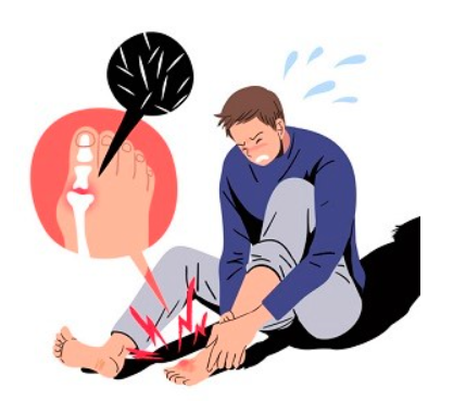  통풍 증상 및 합병증