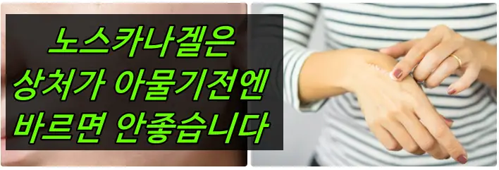 노스카나겔 효과없음 이유