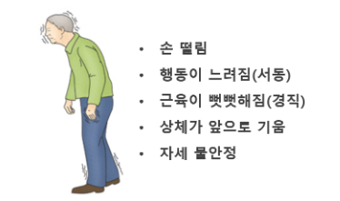 파킨슨 환자의 신체 특징 그림- 상체가 앞으로 기울고 자세가 불안정함