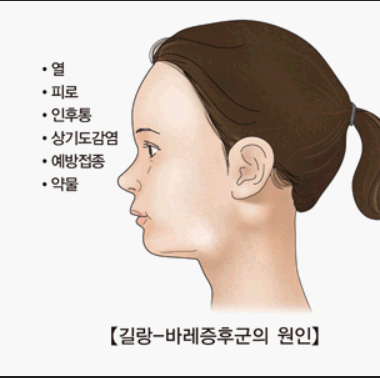 길랭-바레증후군 증상