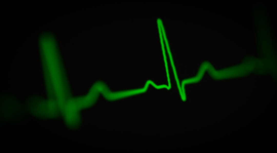 ECG