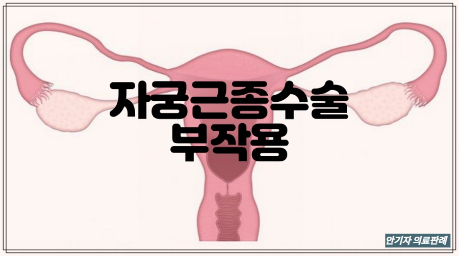 자궁근종용해술 부작용 사진