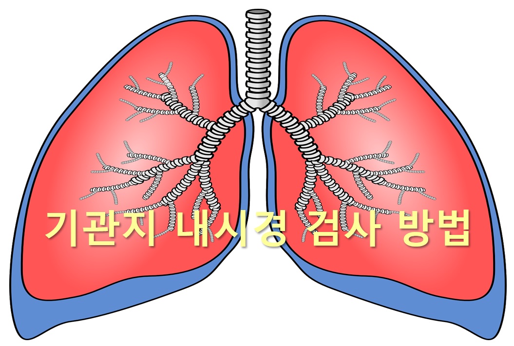  기관지 질환이나 폐암이 의심될 때 기관지 내시경 검사 방법