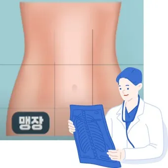 맹장 위치 남자 여자_20