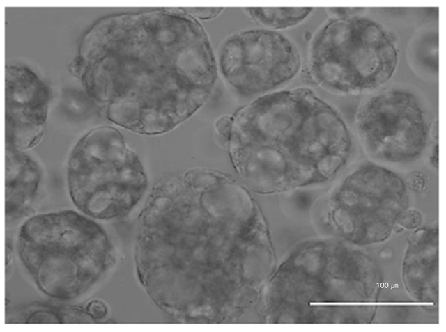 인간 배아줄기세포로부터 분화한 췌도 오가노이드/사진=카이스트 생명과학과 한용만 교수 제공