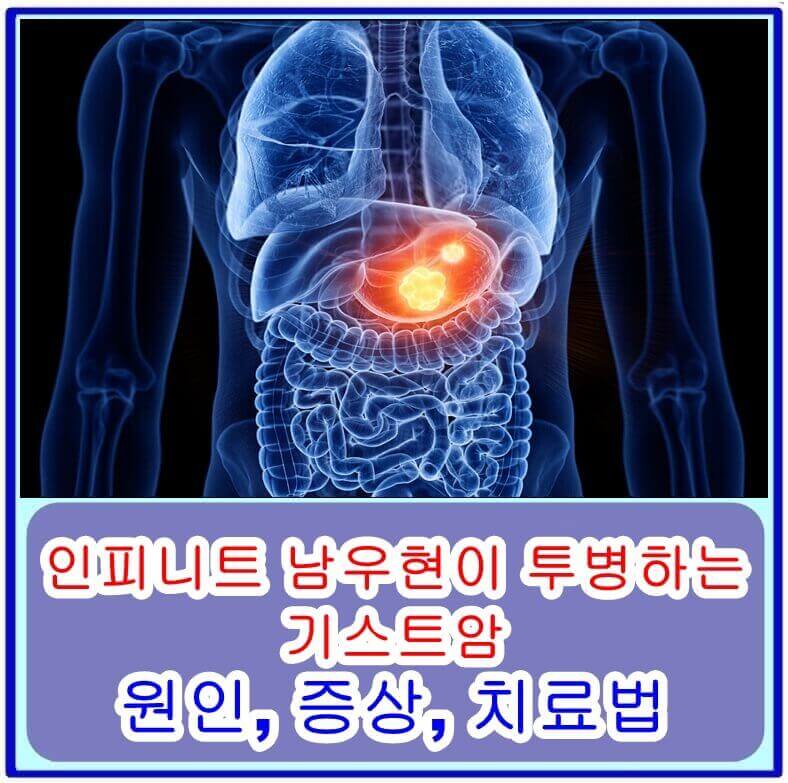  인피니트 남우현이 투병하는 기스트암의 원인, 증상, 치료법