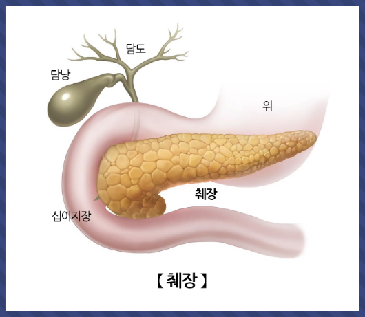 췌장암 초기증상 및 원인 조기 대처방법