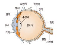  노안 증상 과 수술