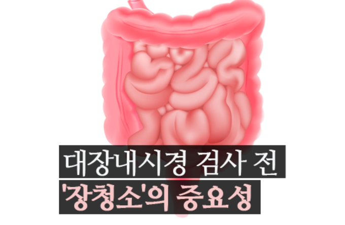 대장내시경 검사 전 장청소