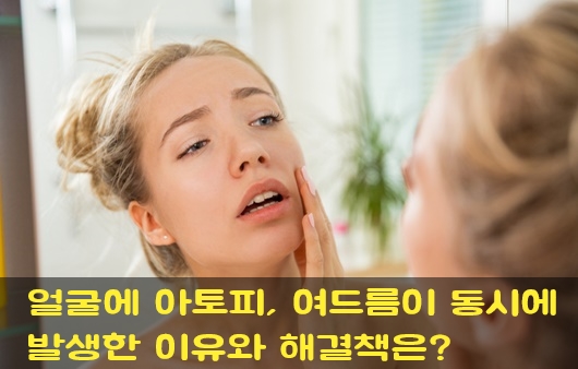  성인얼굴아토피, 얼굴에 아토피, 여드름 증상이 동시에 발생한 이유!
