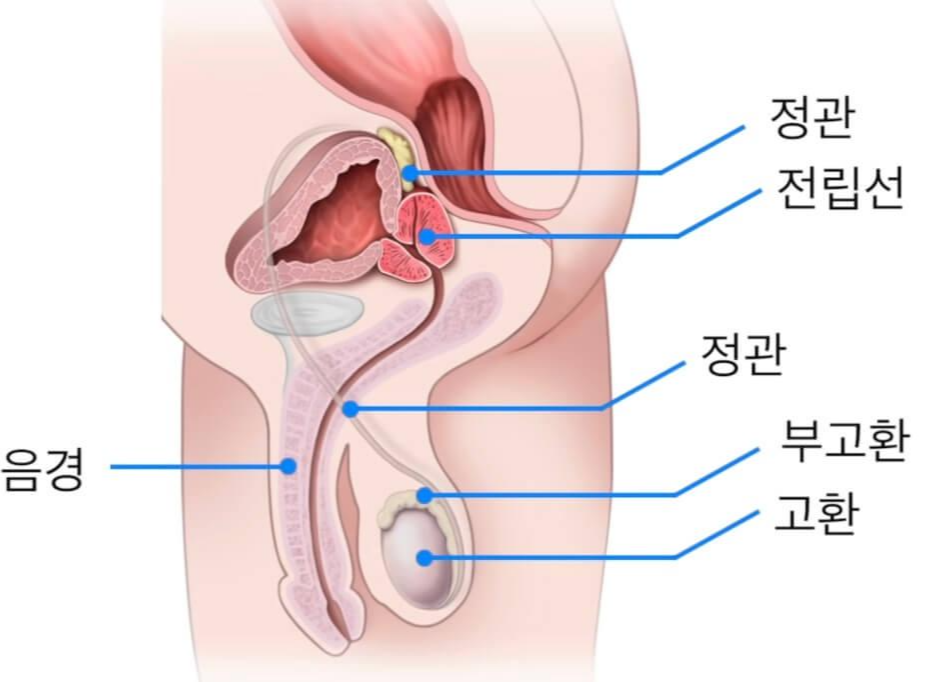  전립선암 초기증상 없다! - 대표증상 2가지 및 예방법