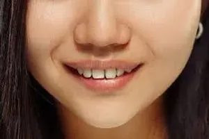 치아