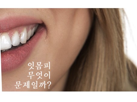  잇몸피 무엇이 문제일까? 원인&증상 총정리