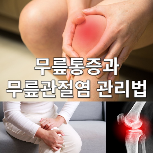 무릎통증과 무릎관절염 관리법