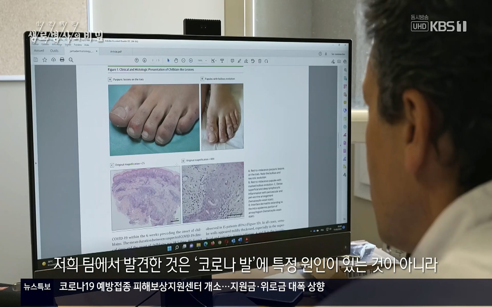생로병사의 비밀.E827.220720p.H264-F1RST.mp4_20220721_203836.682.jpg