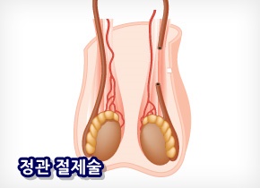 엘비뇨기과의원 이미지