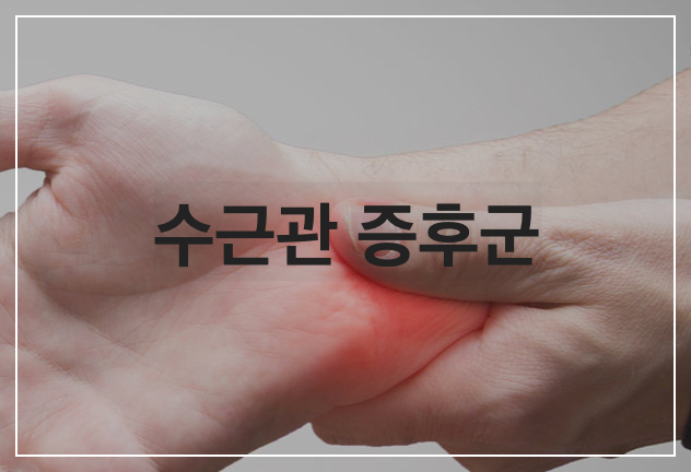 수근관 증후군이란? 뜻 기본정보